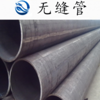 廠家直銷天津大無縫 20號精密無縫鋼管 20#無縫管 品質(zhì)保證